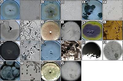 Antibacterial and anticancer potential of bioactive compounds and secondary metabolites of endophytic fungi isolated from Anethum graveolens